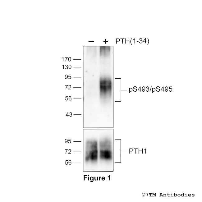 Phospho-Parathyroid Hormone Receptor 1 (Ser493, Ser495) Antibody in Western Blot (WB)