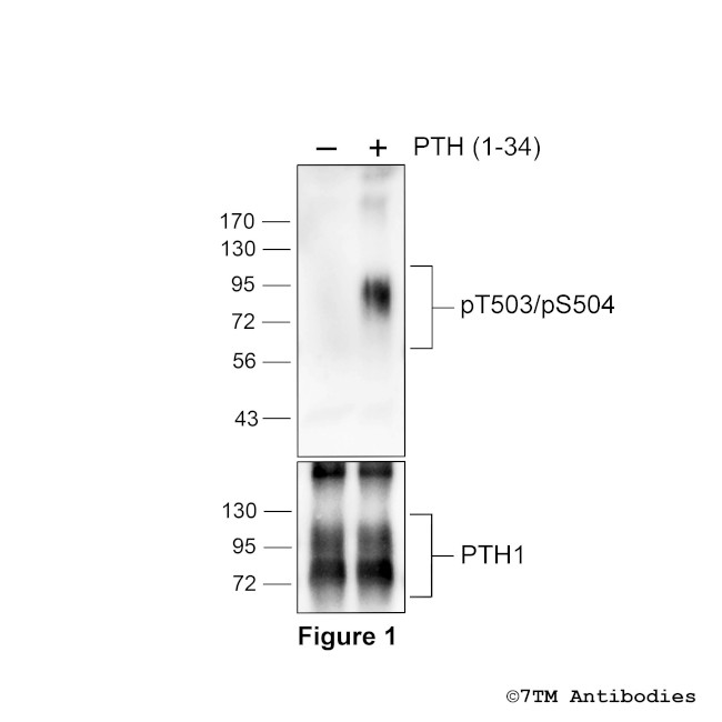 Phospho-Parathyroid Hormone Receptor 1 (Thr503, Ser504) Antibody in Western Blot (WB)