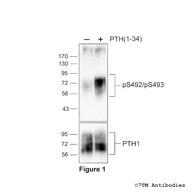 Phospho-Parathyroid Hormone Receptor 1 (Ser492, Ser493) Antibody in Western Blot (WB)