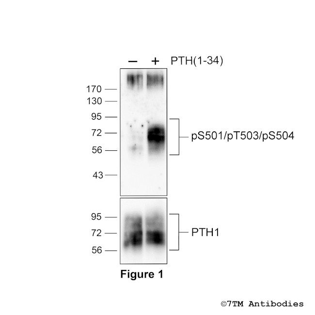 Phospho-Parathyroid Hormone Receptor 1 (Ser501, Thr503, Ser504) Antibody in Western Blot (WB)