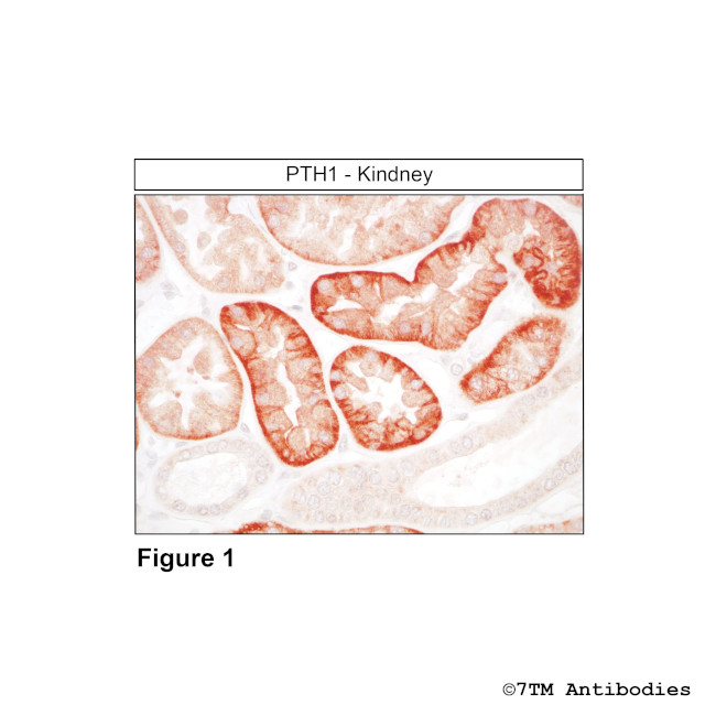 PTH1, Parathyroid Hormone Receptor 1 Antibody in Immunohistochemistry (Paraffin) (IHC (P))
