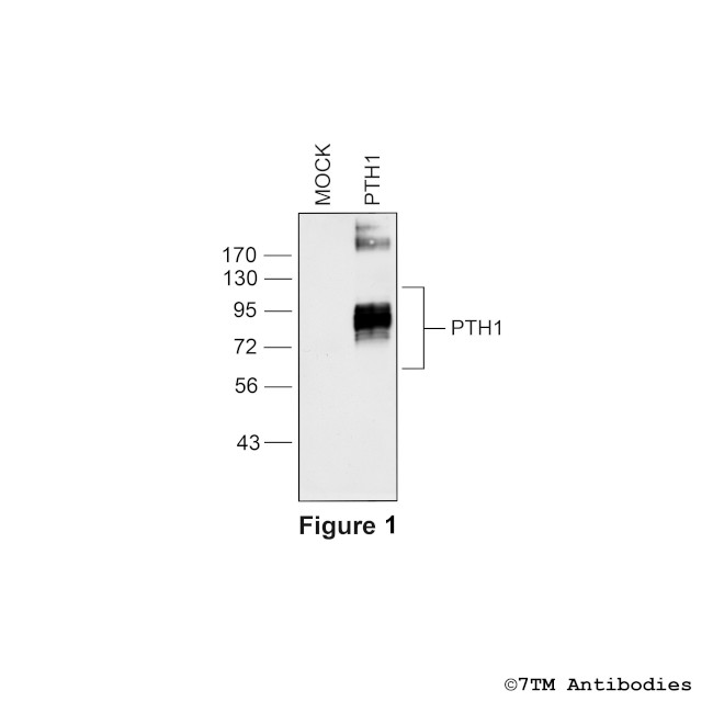 PTH1 (Parathyroid Hormone Receptor 1) Antibody in Western Blot (WB)