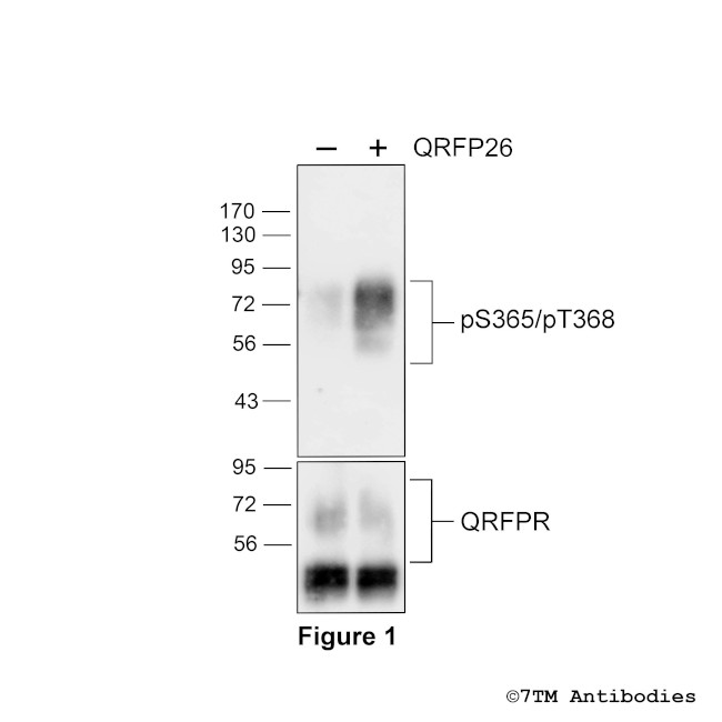 Phospho-QRFP Receptor (Ser365, Thr368) Antibody in Western Blot (WB)