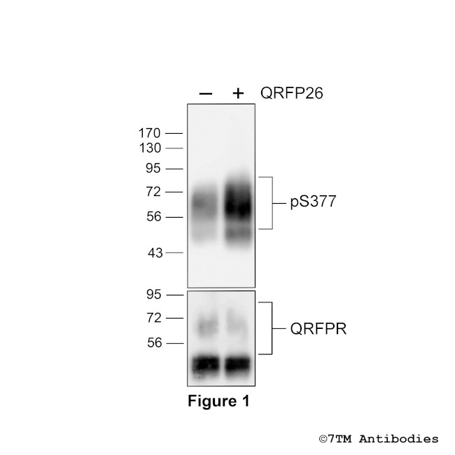 Phospho-QRFP Receptor (Ser377) Antibody in Western Blot (WB)