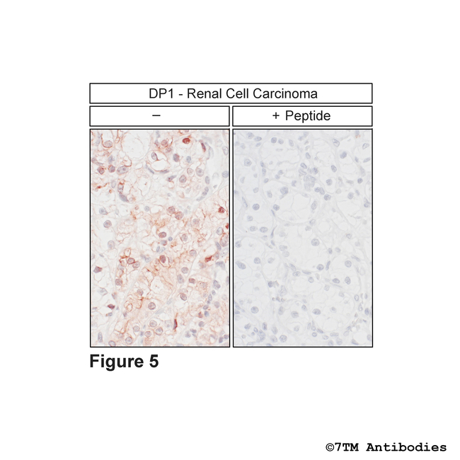 DP1, DP1 Prostanoid Receptor Antibody in Immunohistochemistry (Paraffin) (IHC (P))