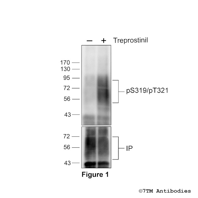 Phospho-IP Prostacyclin Receptor (Ser319, Thr321) Antibody in Western Blot (WB)