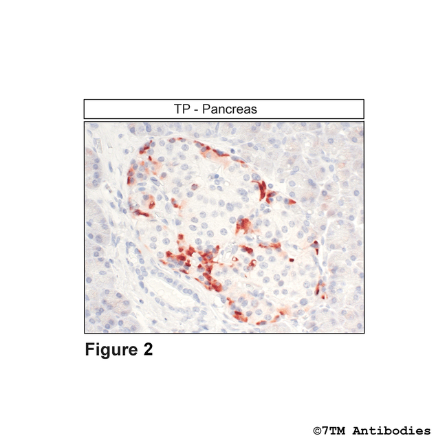 TP, TP Thromboxane Receptor Antibody in Immunohistochemistry (Paraffin) (IHC (P))