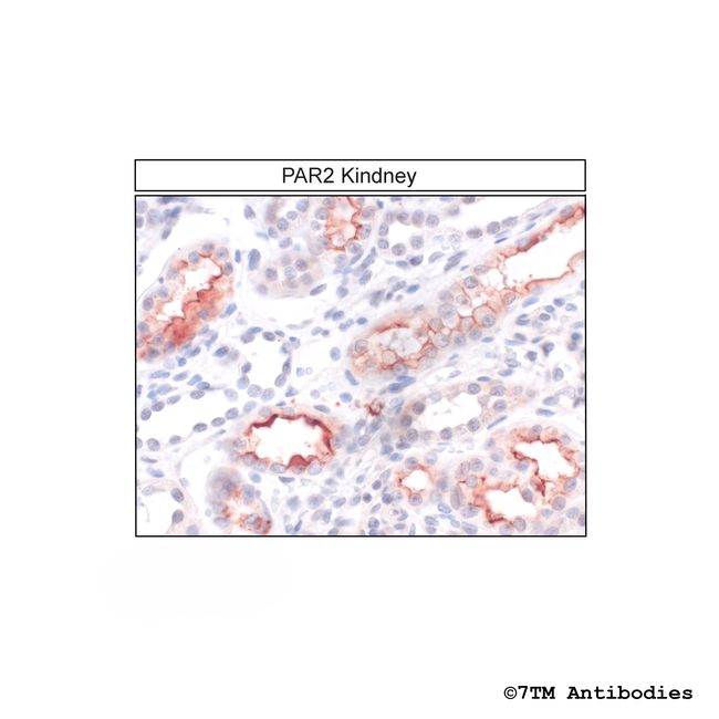 PAR2, Proteinase-Activated Receptor 2 Antibody in Immunohistochemistry (Paraffin) (IHC (P))