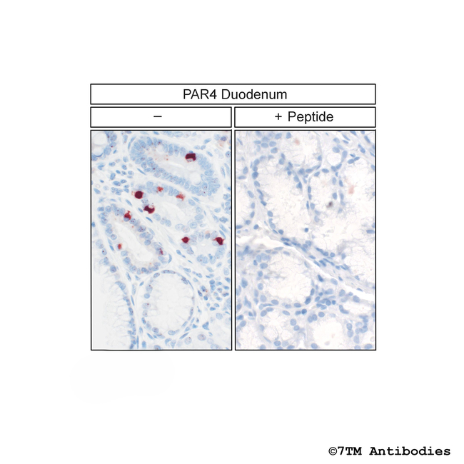 PAR4, Proteinase-Activated Receptor 4 Antibody in Immunohistochemistry (Paraffin) (IHC (P))