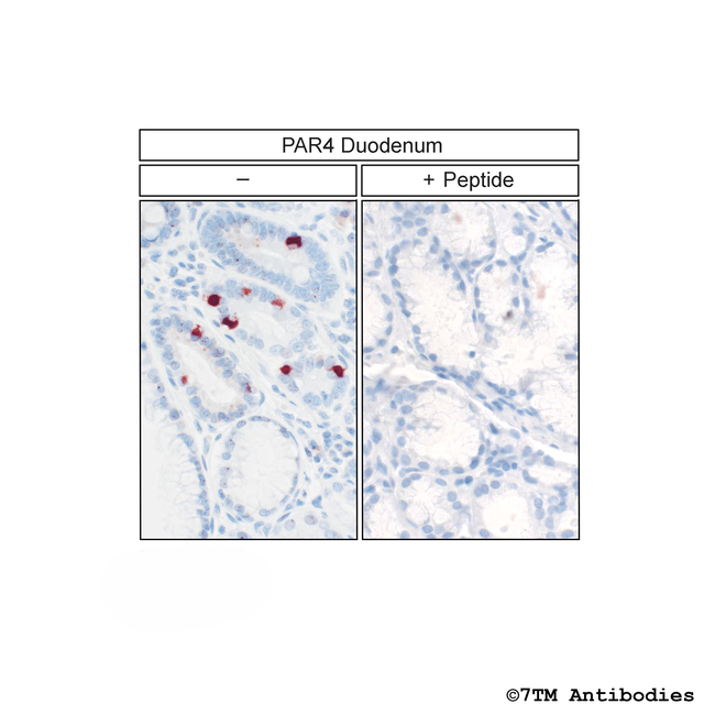 PAR4, Proteinase-Activated Receptor 4 Antibody in Immunohistochemistry (Paraffin) (IHC (P))