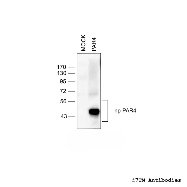 PAR4, Proteinase-Activated Receptor 4 Antibody in Western Blot (WB)