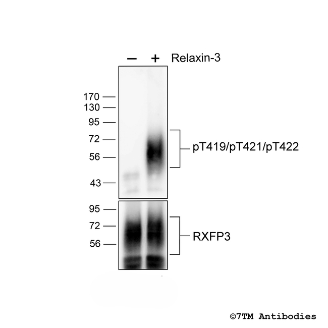 Phospho-Relaxin Receptor 3 (Thr419, Thr421, Thr422) Antibody in Western Blot (WB)
