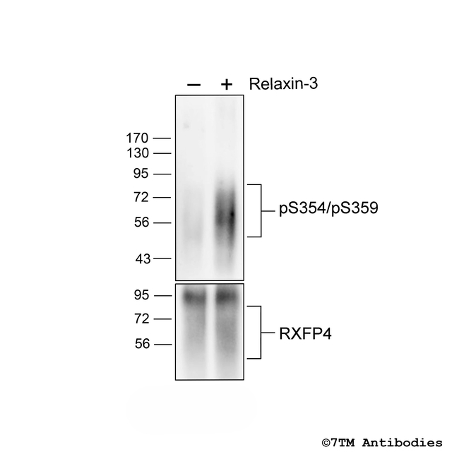 Phospho-Relaxin Receptor 4 (Ser354, Ser359) Antibody in Western Blot (WB)