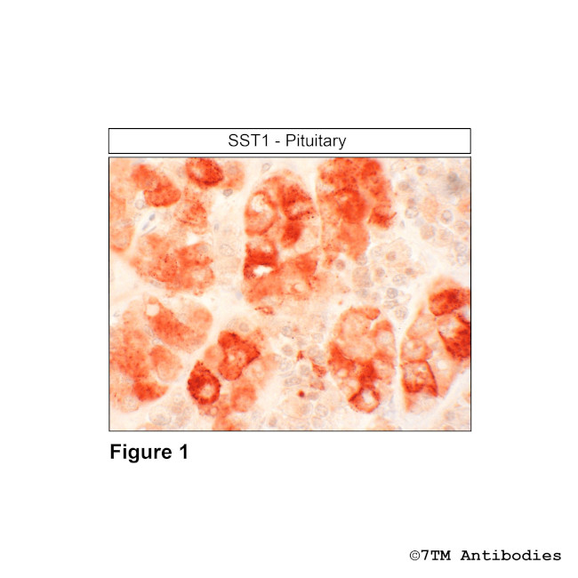 SST1, Somatostatin Receptor 1 Antibody in Immunohistochemistry (Paraffin) (IHC (P))
