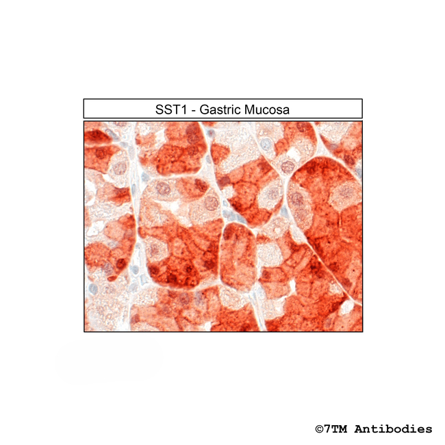 SST1 (Somatostatin Receptor 1) Antibody in Immunohistochemistry (Paraffin) (IHC (P))
