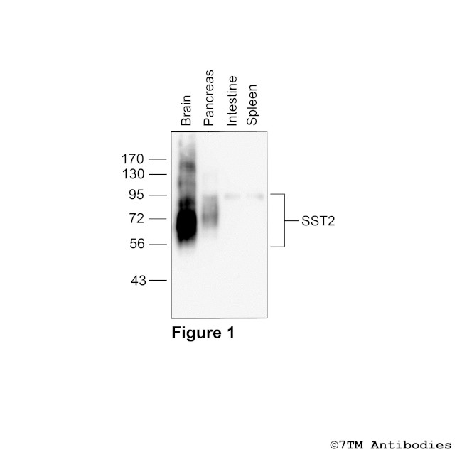 SST2, Somatostatin Receptor 2 Antibody in Western Blot (WB)