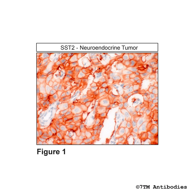 SST2, Somatostatin Receptor 2 Antibody in Immunohistochemistry (Paraffin) (IHC (P))