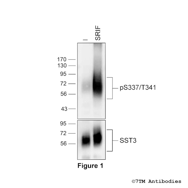Phospho-Somatostatin Receptor 3 (Ser337, Thr341) Antibody in Western Blot (WB)