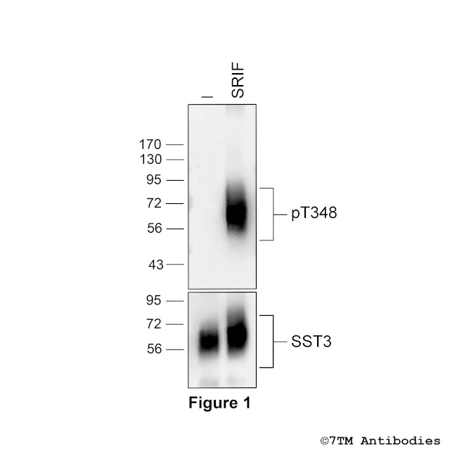 Phospho-Somatostatin Receptor 3 (Thr348) Antibody in Western Blot (WB)