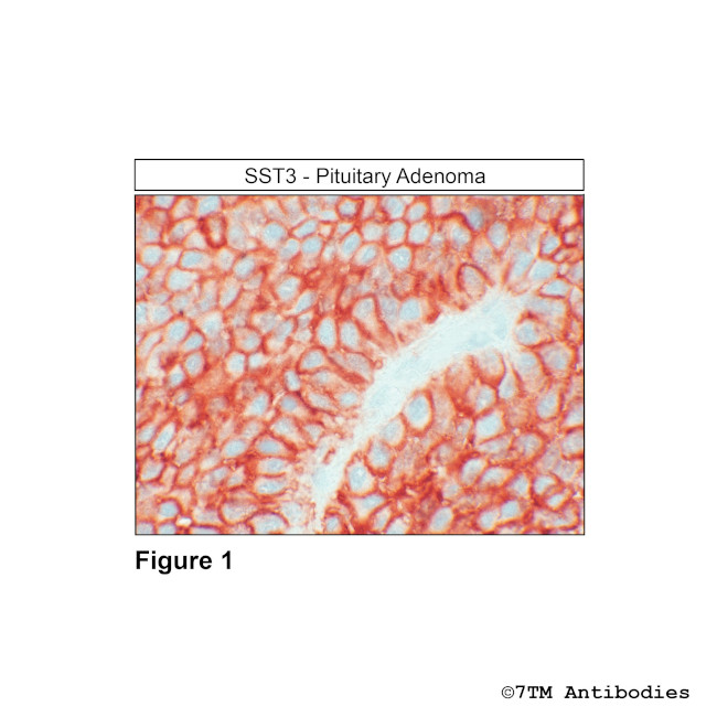 SST3, Somatostatin Receptor 3 Antibody in Immunohistochemistry (Paraffin) (IHC (P))