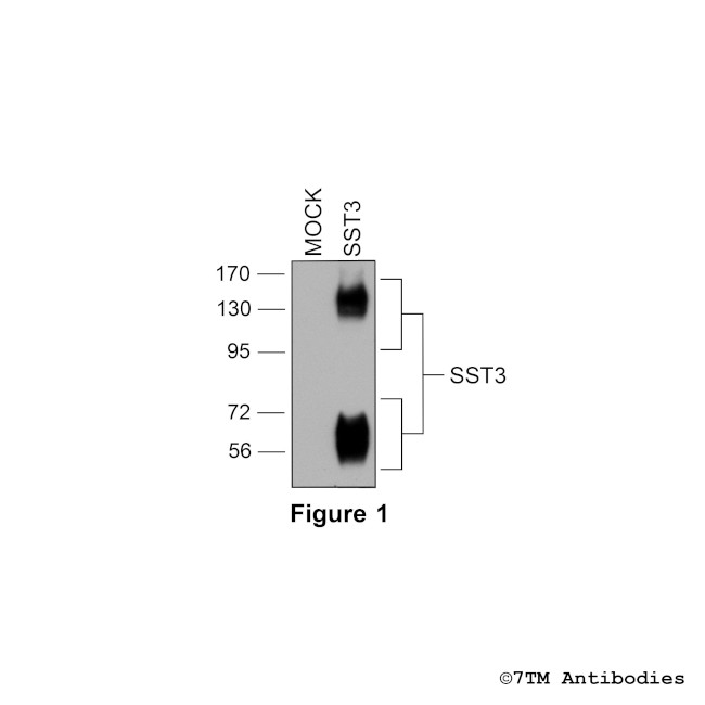 SST3, Somatostatin Receptor 3 Antibody in Western Blot (WB)
