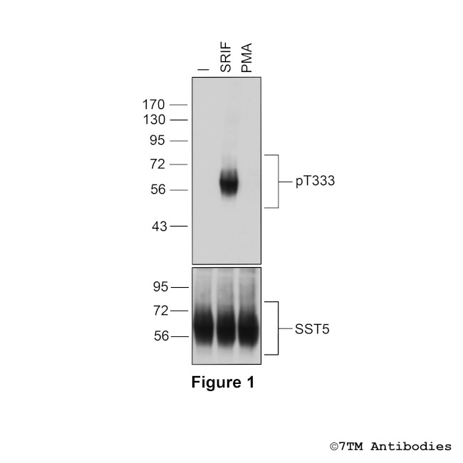 Phospho-Somatostatin Receptor 5 (Thr333) Antibody in Western Blot (WB)