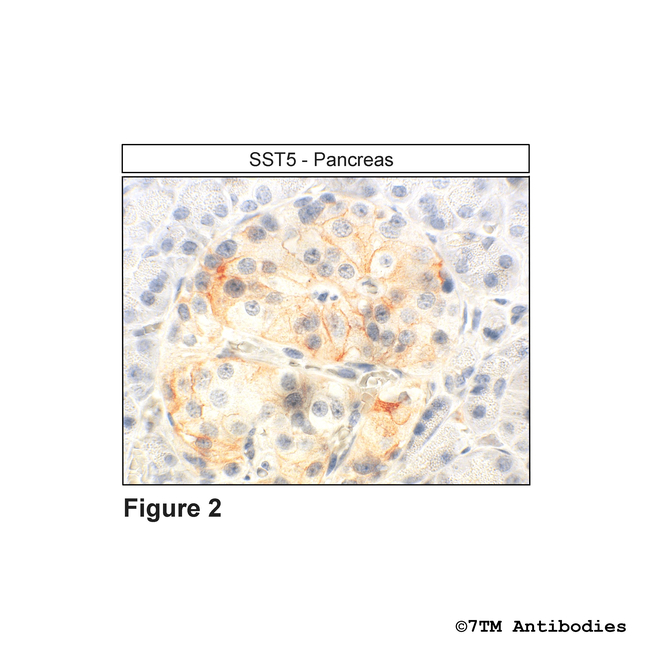 SST5, Somatostatin Receptor 5 Antibody in Immunohistochemistry (Paraffin) (IHC (P))