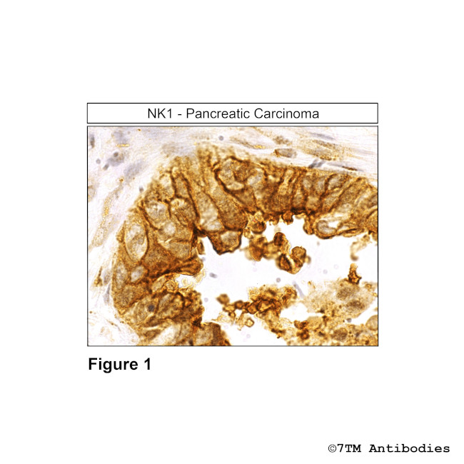 NK1, Tachykinin Receptor 1 Receptor Antibody in Immunohistochemistry (Paraffin) (IHC (P))