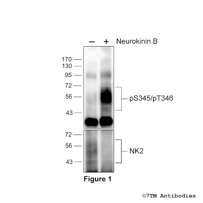 Phospho-Tachykinin Receptor 2 (Ser345, Thr346) Antibody in Western Blot (WB)