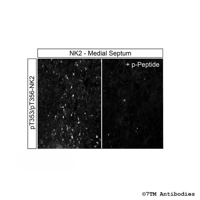 Phospho-Tachykinin Receptor 2 (Thr353, Thr356) Antibody in Immunohistochemistry (Paraffin) (IHC (P))