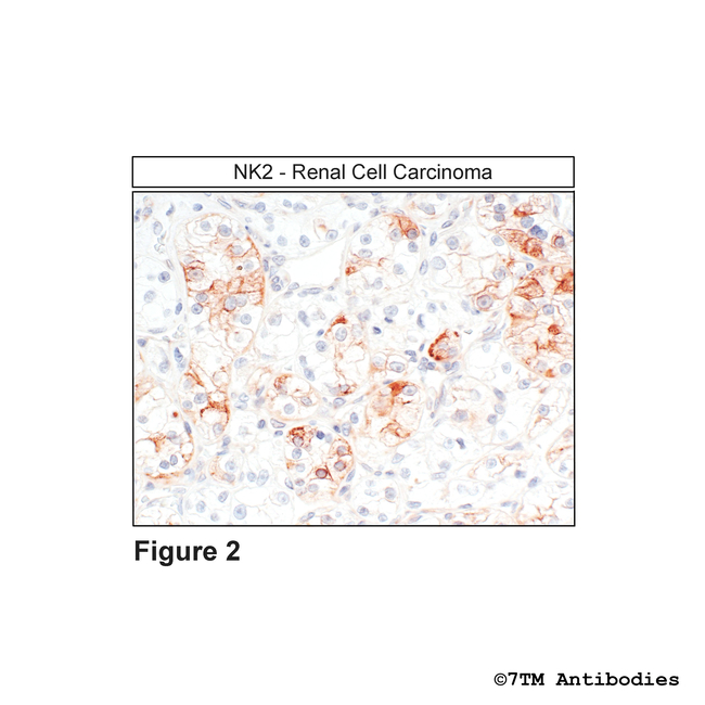 NK2, Tachykinin Receptor 2 Antibody in Immunohistochemistry (Paraffin) (IHC (P))