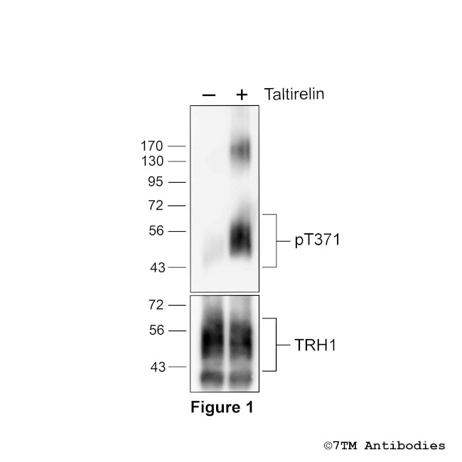 Phospho-Thyrotropin-Releasing Hormone Receptor 1 (Thr371) Antibody in Western Blot (WB)