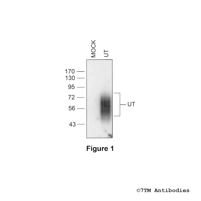 UT, Urotensin Receptor Antibody in Western Blot (WB)