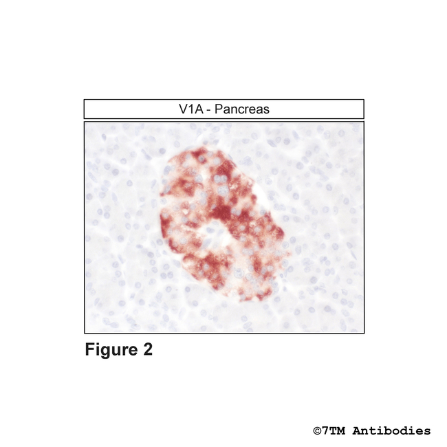 V1A, Vasopressin Receptor 1A Antibody in Immunohistochemistry (Paraffin) (IHC (P))