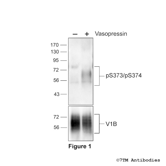 Phospho-Vasopressin Receptor 1B (Ser373, Ser374) Antibody in Western Blot (WB)