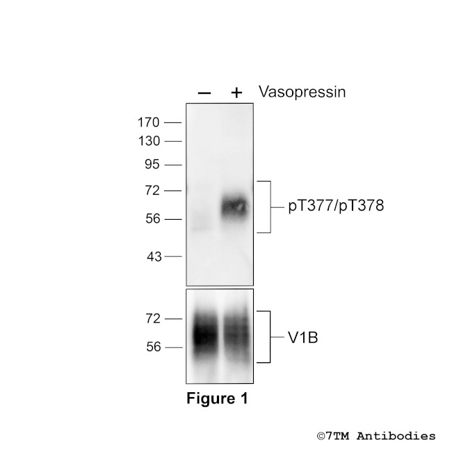 Phospho-Vasopressin Receptor 1B (Thr377, Thr378) Antibody in Western Blot (WB)