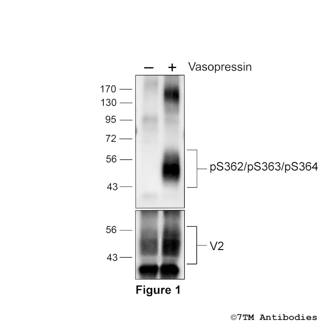 Phospho-Vasopressin Receptor 2 (Ser362, Ser363, Ser364) Antibody in Western Blot (WB)