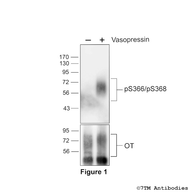 Phospho-Oxytocin Receptor (Ser366, Ser368) Antibody in Western Blot (WB)