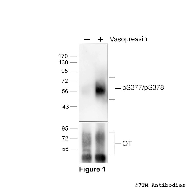 Phospho-Oxytocin Receptor (Ser377, Ser378) Antibody in Western Blot (WB)