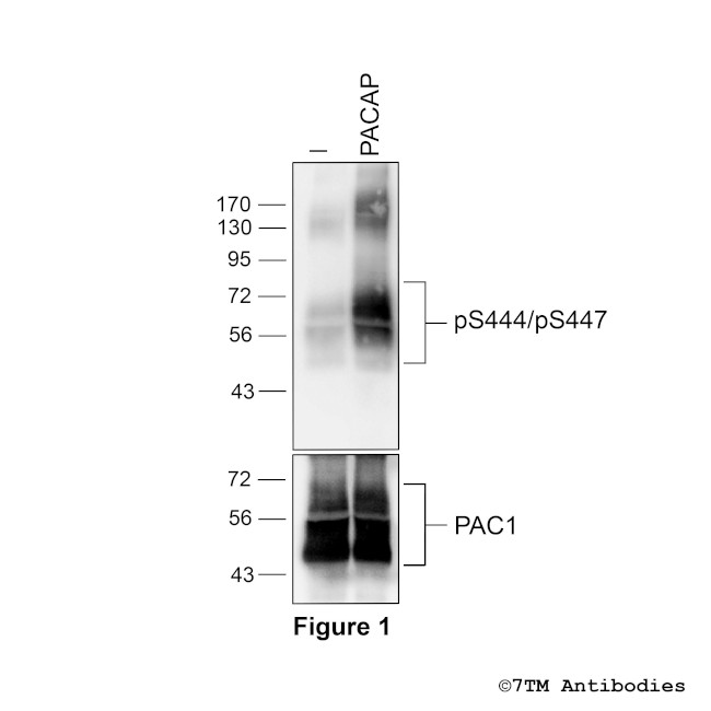 Phospho-PACAP Receptor 1 (Thr444, Ser447) Antibody in Western Blot (WB)