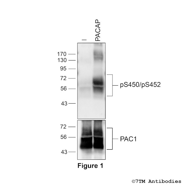 Phospho-PACAP Receptor 1 (Ser450, Ser452) Antibody in Western Blot (WB)