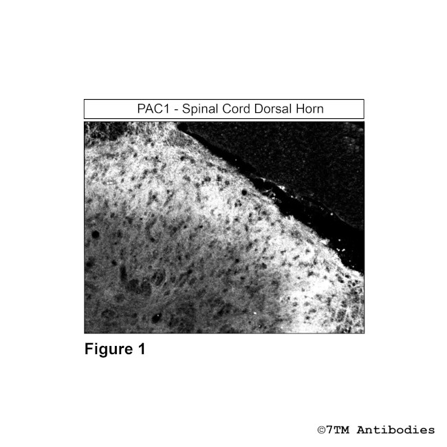 PAC1, PACAP Receptor 1 Antibody in Immunohistochemistry (Paraffin) (IHC (P))