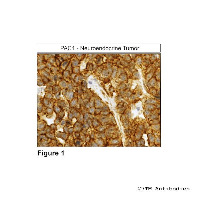 PAC1, PACAP Receptor 1 Antibody in Immunohistochemistry (Paraffin) (IHC (P))