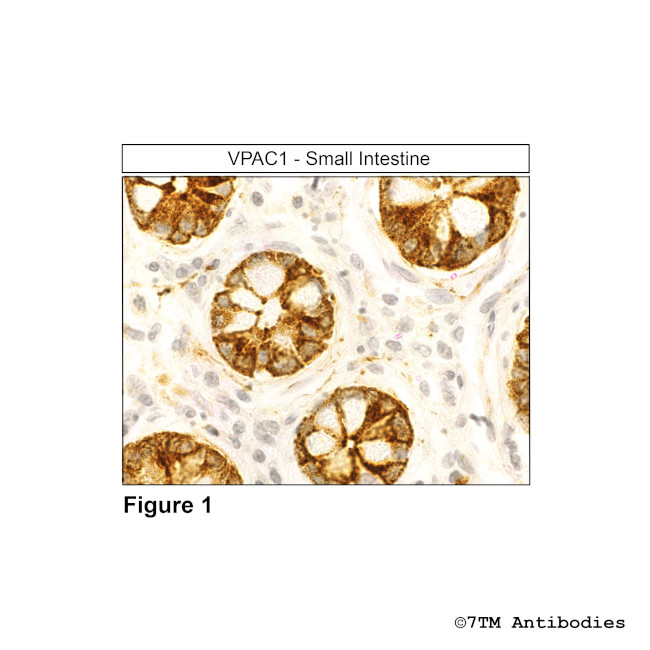 VPAC1, VIP Receptor 1 Antibody in Immunohistochemistry (Paraffin) (IHC (P))