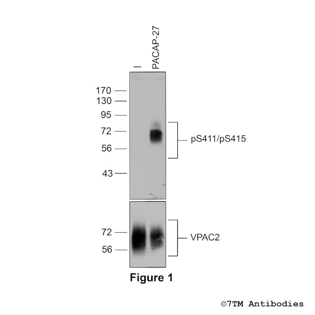 Phospho-VIP Receptor 2 (Ser411, Ser415) Antibody in Western Blot (WB)