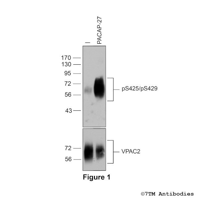 Phospho-VIP Receptor 2 (Ser425, Ser429) Antibody in Western Blot (WB)