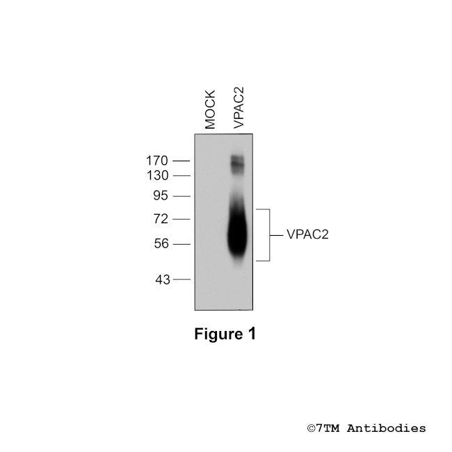 VPAC2, VIP Receptor 2 Antibody in Western Blot (WB)
