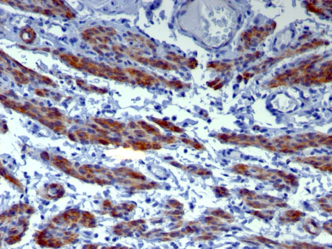 Caldesmon, HMW (h-Caldesmon) (Smooth Muscle Marker) Antibody in Immunohistochemistry (Paraffin) (IHC (P))