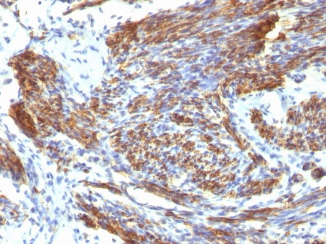 Caldesmon, HMW (h-Caldesmon) (Smooth Muscle Marker) Antibody in Immunohistochemistry (Paraffin) (IHC (P))