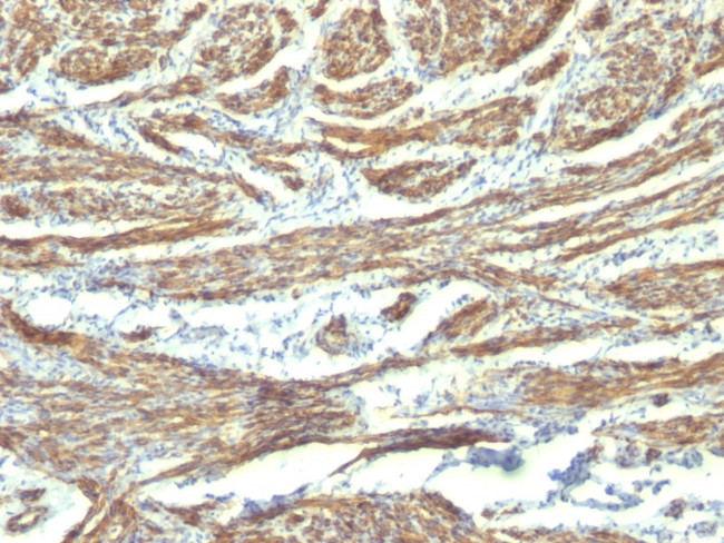 Caldesmon, HMW (h-Caldesmon) (Smooth Muscle Marker) Antibody in Immunohistochemistry (Paraffin) (IHC (P))